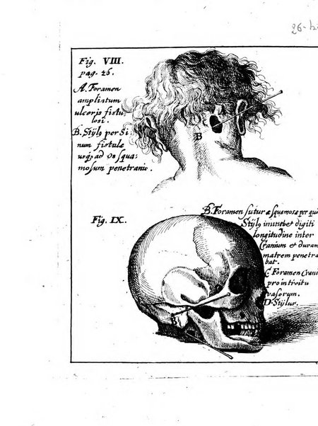 Miscellanea curiosa medico-physica Academiae naturae curiosorum sive ephemeridum medico-physicarum Germanicarum..