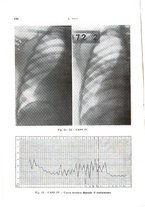 giornale/TO00200581/1938/unico/00000036