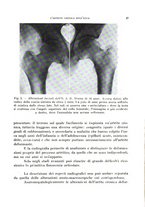 giornale/TO00200581/1938/unico/00000093