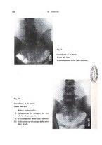 giornale/TO00200581/1939/unico/00000244