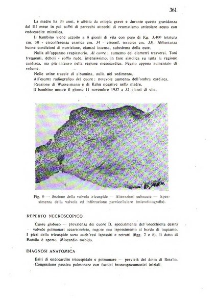 Policlinico infantile rivista mensile di medicina e chirurgia dei bambini