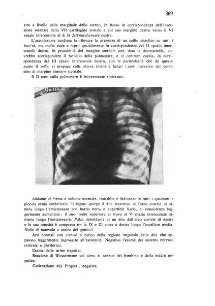 Policlinico infantile rivista mensile di medicina e chirurgia dei bambini