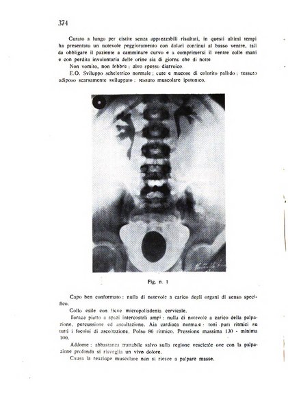 Policlinico infantile rivista mensile di medicina e chirurgia dei bambini