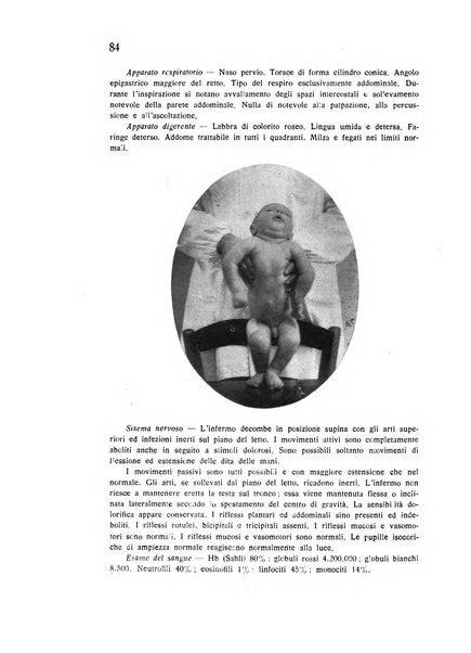 Policlinico infantile rivista mensile di medicina e chirurgia dei bambini