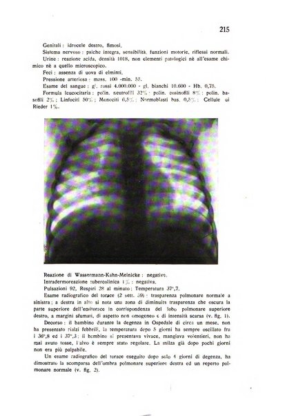 Policlinico infantile rivista mensile di medicina e chirurgia dei bambini