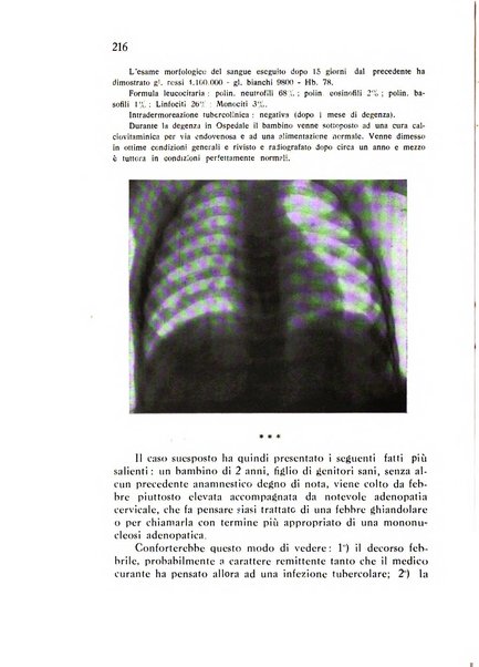 Policlinico infantile rivista mensile di medicina e chirurgia dei bambini