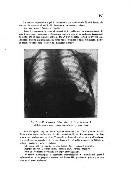 Policlinico infantile rivista mensile di medicina e chirurgia dei bambini