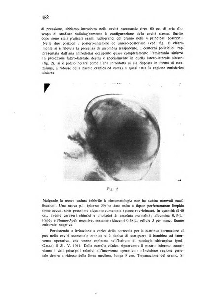 Policlinico infantile rivista mensile di medicina e chirurgia dei bambini