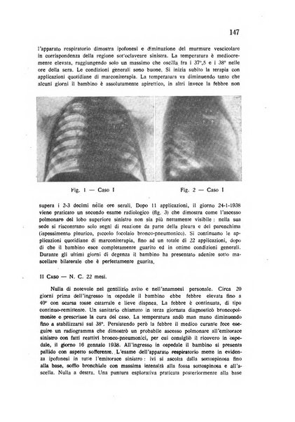 Policlinico infantile rivista mensile di medicina e chirurgia dei bambini