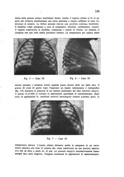 Policlinico infantile rivista mensile di medicina e chirurgia dei bambini