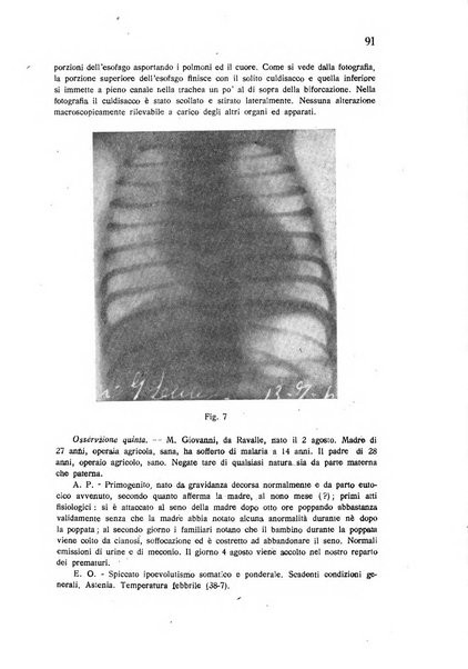 Policlinico infantile rivista mensile di medicina e chirurgia dei bambini