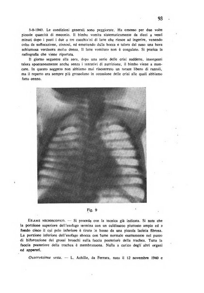 Policlinico infantile rivista mensile di medicina e chirurgia dei bambini