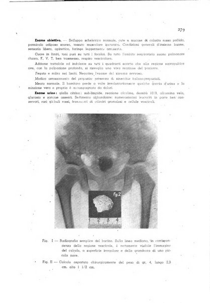 Policlinico infantile rivista mensile di medicina e chirurgia dei bambini