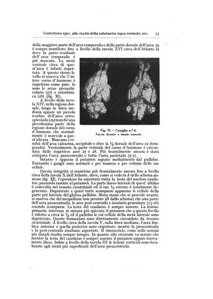 Archivio generale di neurologia, psichiatria e psicoanalisi