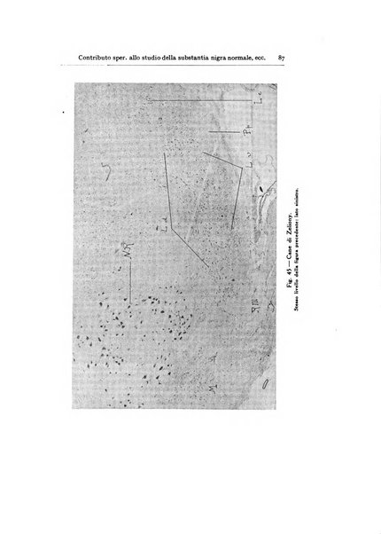 Archivio generale di neurologia, psichiatria e psicoanalisi