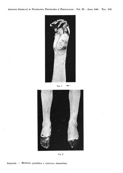 Archivio generale di neurologia, psichiatria e psicoanalisi