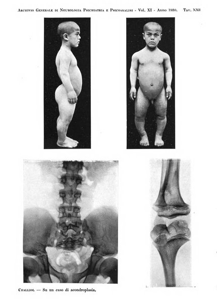 Archivio generale di neurologia, psichiatria e psicoanalisi