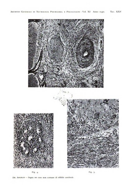 Archivio generale di neurologia, psichiatria e psicoanalisi