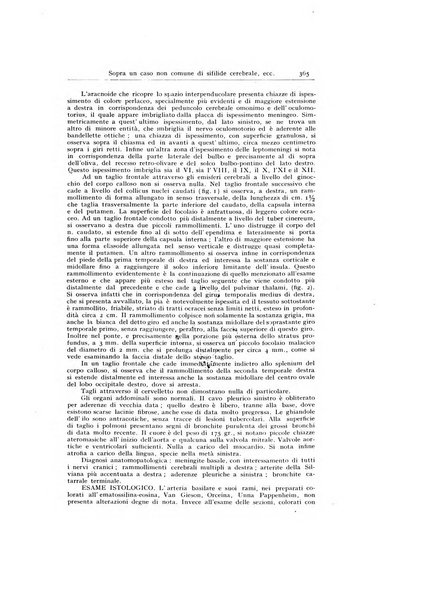 Archivio generale di neurologia, psichiatria e psicoanalisi