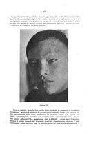 giornale/TO00210724/1915/unico/00000025