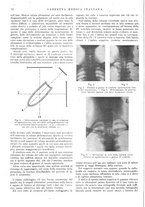 giornale/TO00214288/1938/unico/00000106