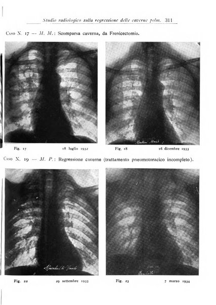 Annali dell'Istituto Maragliano archivi di biologia applicata alla patologia, alla clinica e all'igiene