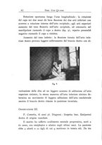 giornale/TO00215510/1935/unico/00000086