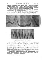 giornale/TO00215755/1920/unico/00000390