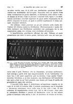 giornale/TO00215755/1921/unico/00000381