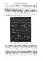 giornale/TO00215755/1922/unico/00000381