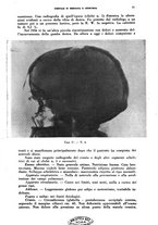 giornale/TO00215878/1939/unico/00000041