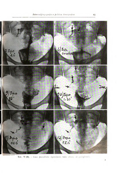 Annali di radiologia diagnostica