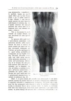 giornale/TO00216169/1941/unico/00000179