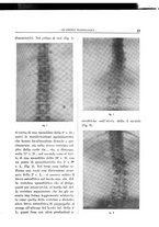 giornale/TO00216400/1930/unico/00000025