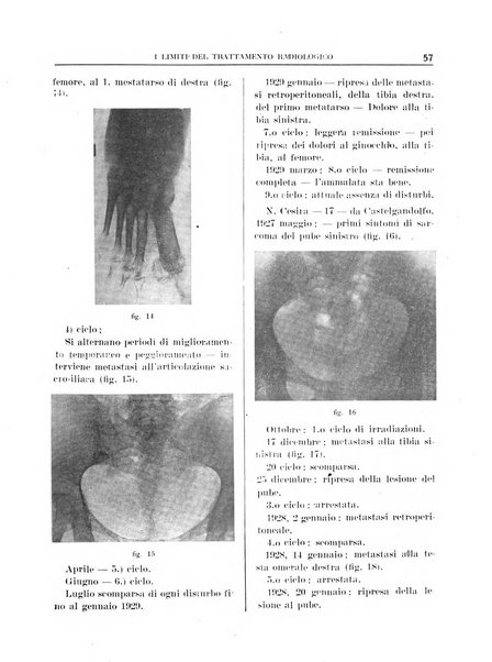 Quaderni radiologici rivista bimestrale di radiologia pratica