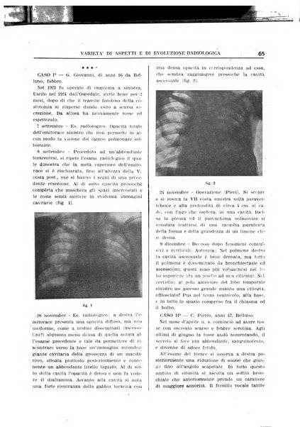 Quaderni radiologici rivista bimestrale di radiologia pratica