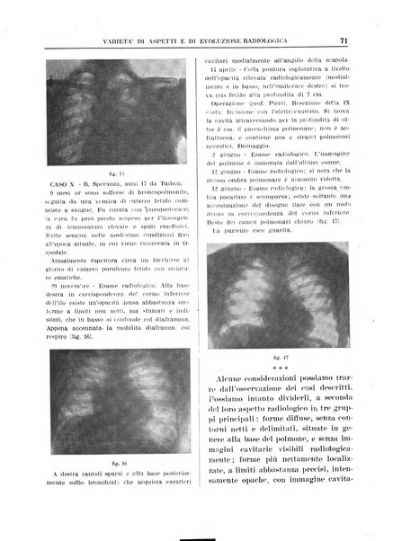 Quaderni radiologici rivista bimestrale di radiologia pratica