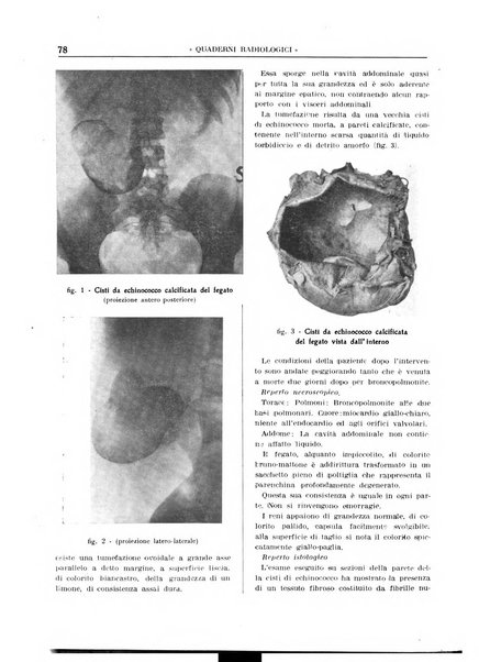 Quaderni radiologici rivista bimestrale di radiologia pratica