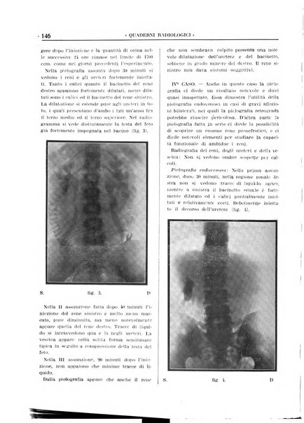 Quaderni radiologici rivista bimestrale di radiologia pratica