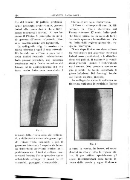 Quaderni radiologici rivista bimestrale di radiologia pratica