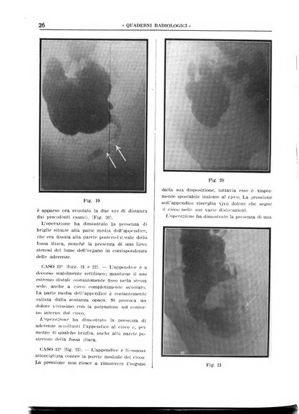 Quaderni radiologici rivista bimestrale di radiologia pratica