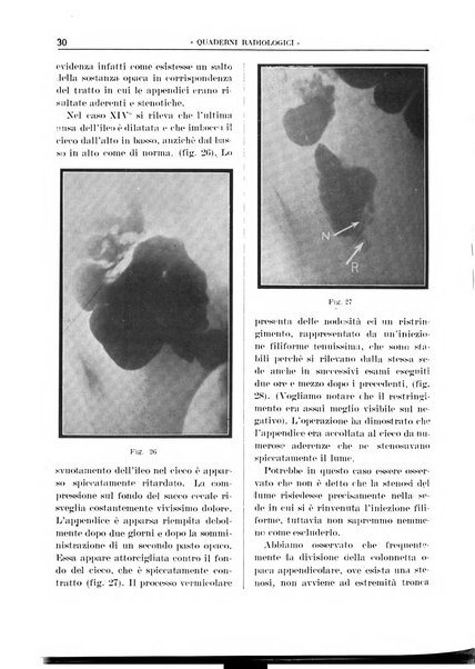 Quaderni radiologici rivista bimestrale di radiologia pratica