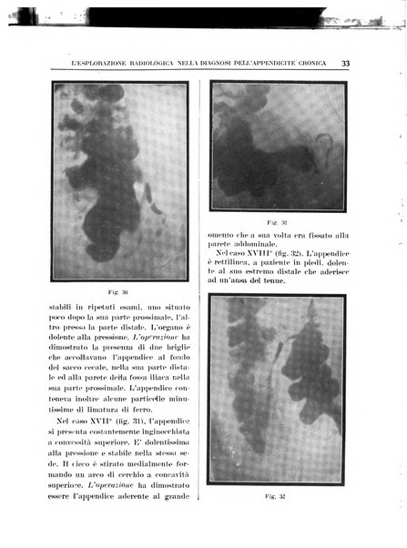 Quaderni radiologici rivista bimestrale di radiologia pratica