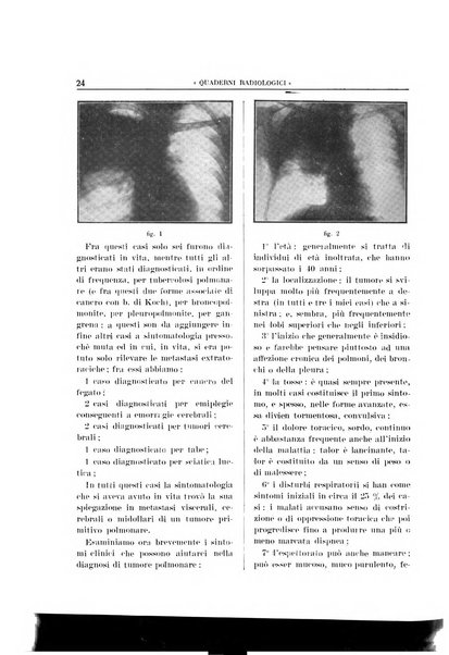 Quaderni radiologici rivista bimestrale di radiologia pratica