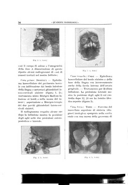 Quaderni radiologici rivista bimestrale di radiologia pratica