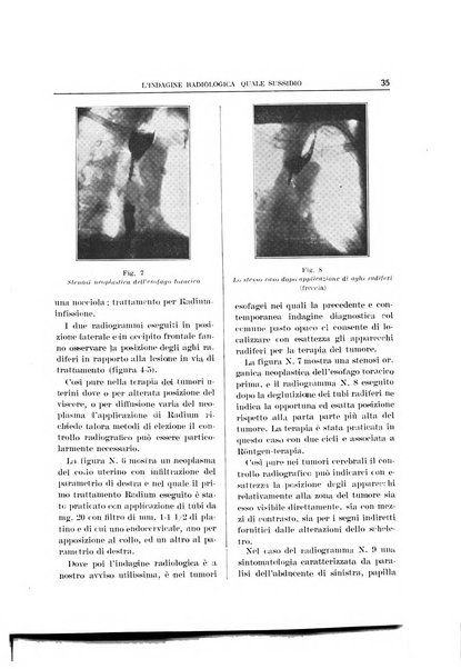 Quaderni radiologici rivista bimestrale di radiologia pratica