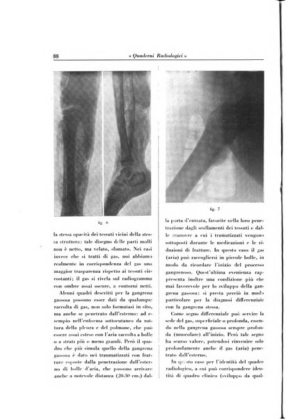 Quaderni radiologici rivista bimestrale di radiologia pratica