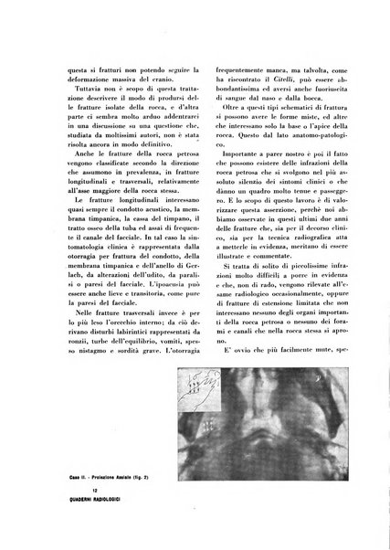 Quaderni radiologici rivista bimestrale di radiologia pratica