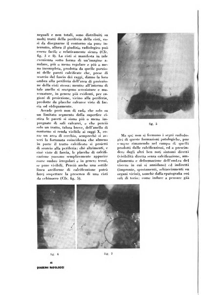 Quaderni radiologici rivista bimestrale di radiologia pratica