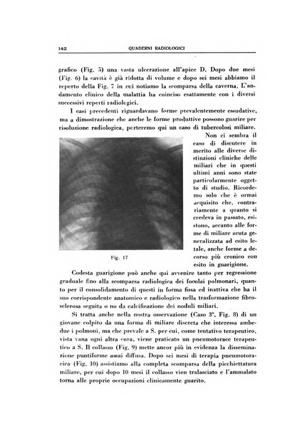 Quaderni radiologici rivista bimestrale di radiologia pratica